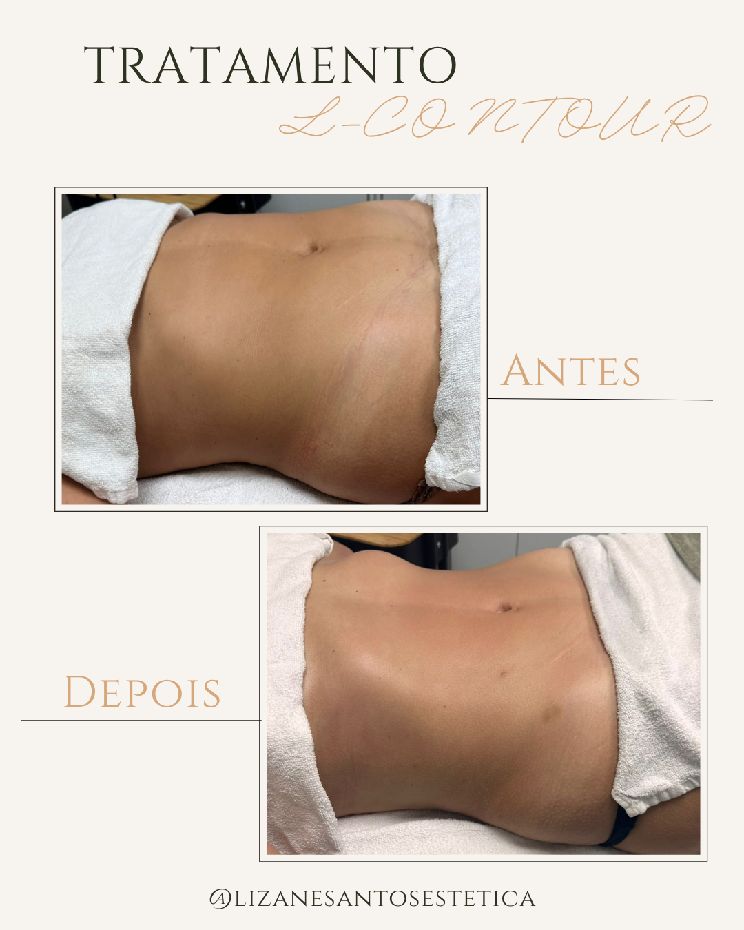L CONTOUR PATRICIA